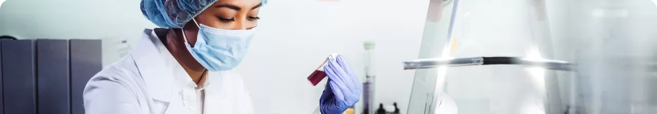 Maladie thromboembolique veineuse et initiation du traitement anticoagulant